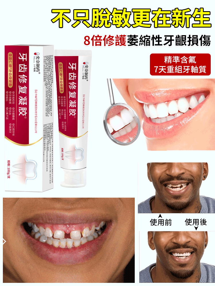 【德國醫用】牙齒修復凝膠 火爆熱銷中！台灣本土出貨！24小時在線客服，售後無憂！現在下單享受在線支付立減活動！